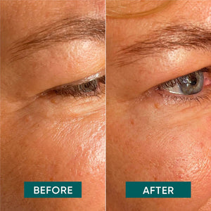 Plasturi antirid Apricot 2 buc - Eye & Temple cu Aloe vera - FIXXIA - 10055